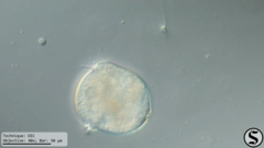 Vorticella campanula