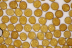 Puccinia laschii