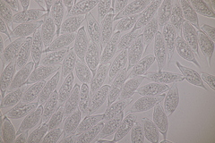 Uredinopsis filicina