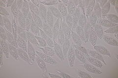 Uredinopsis filicina