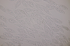 Uredinopsis filicina