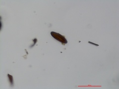 Kretzschmaria micropus