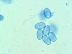 Scutellinia vitreola