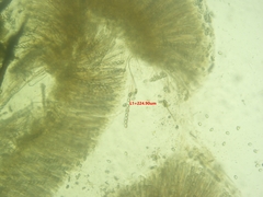 Scutellinia vitreola