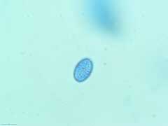 Scutellinia vitreola