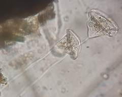 Vorticella campanula