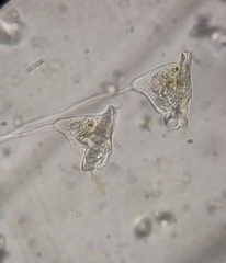 Vorticella campanula