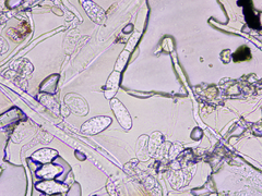 Podosphaera plantaginis