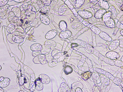 Podosphaera senecionis