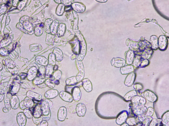 Podosphaera epilobii