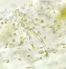 Gongrosira incrustans