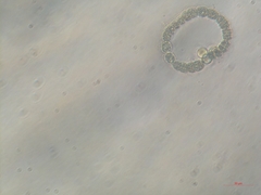 Dolichospermum
