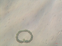 Dolichospermum