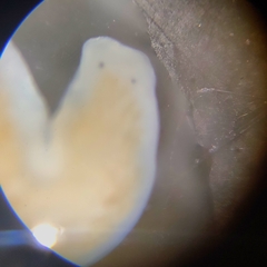 Dendrocoelum lacteum