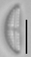 Amphora pediculus