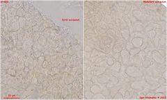 Orbilia luteorubella