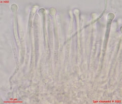 Orbilia luteorubella