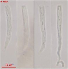 Orbilia luteorubella