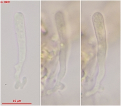 Orbilia xanthostigma