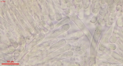 Orbilia xanthostigma