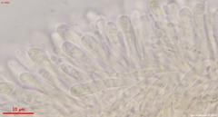 Orbilia xanthostigma