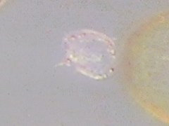 Protoperidinium