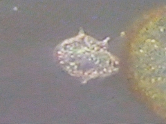 Protoperidinium