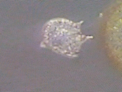 Protoperidinium