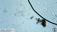 Vorticella campanula