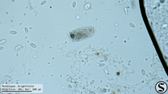 Vorticella campanula