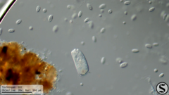 Vorticella campanula