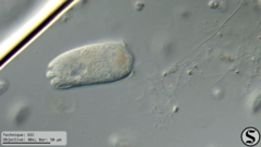 Vorticella campanula