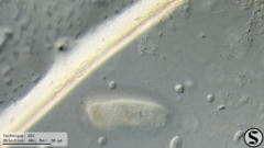 Vorticella campanula