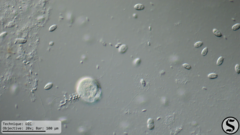 Vorticella campanula