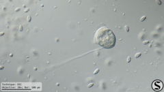 Vorticella campanula