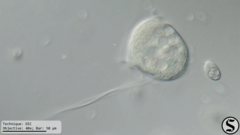 Vorticella campanula