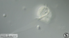 Vorticella campanula