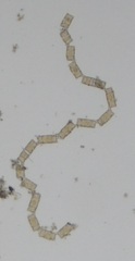 Odontella aurita