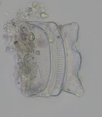 Odontella aurita