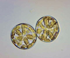 Asteromphalus