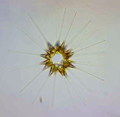 Asterionellopsis glacialis