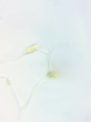 Physarum psittacinum