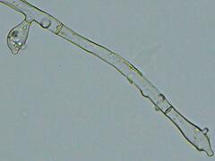 Botryobasidium conspersum