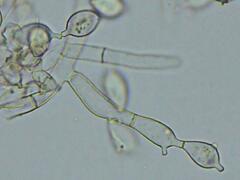 Botryobasidium conspersum