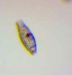 Tiarina fusus