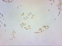 Phaeocystis