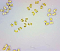 Phaeocystis