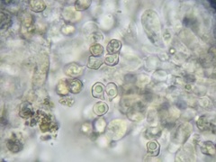Entoloma byssisedum