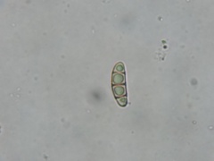 Pleosporaceae
