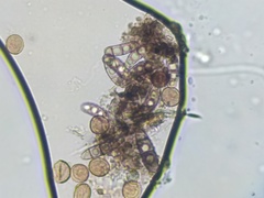 Pleosporaceae
